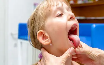 ورم لوزه به چه علت است؟