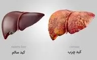 پشت پرده ارتباط مرگبار دیابت و کبد چرب/ دارویی که هر دو را مهار می‌کند!
