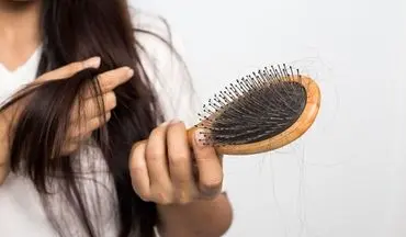 روش‌های طبیعی و ساده برای مقابله با ریزش موی شدید