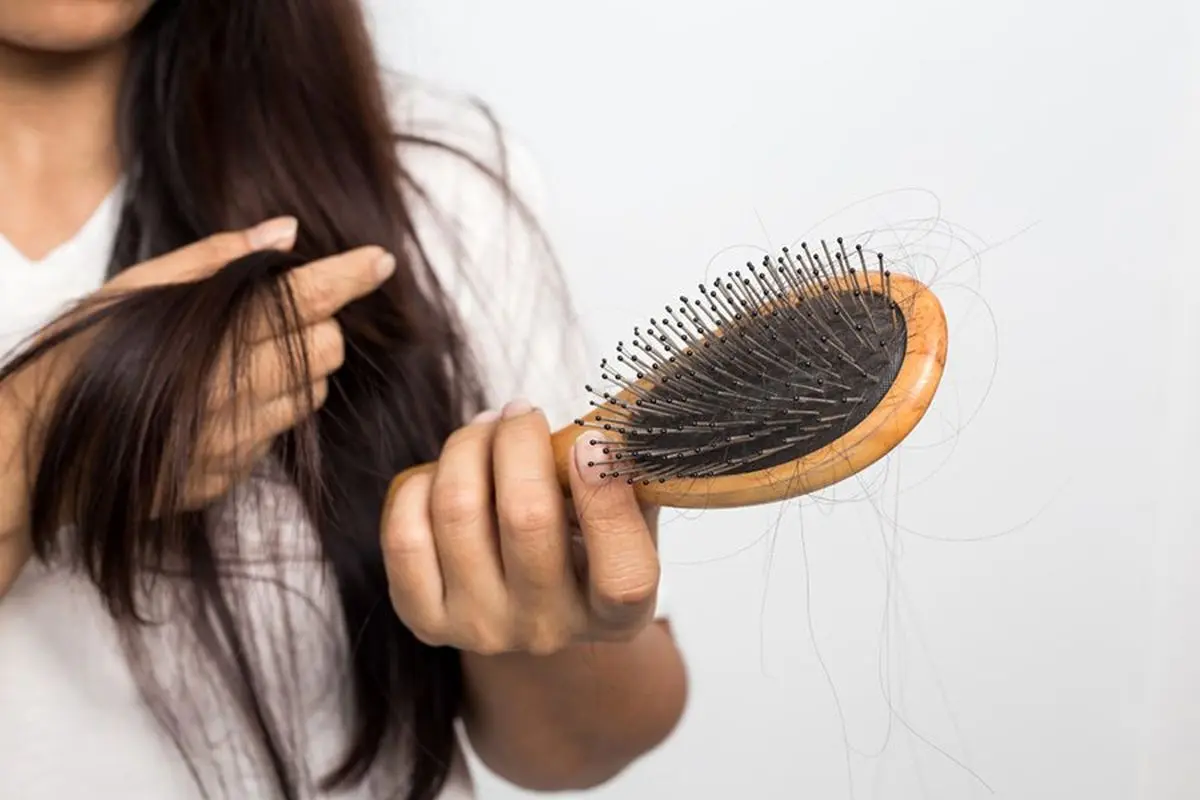 روش‌های طبیعی و ساده برای مقابله با ریزش موی شدید