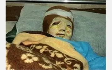 زن سنندجی کباب شد