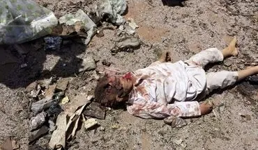 انفجار بمب جا مانده از حملات ائتلاف سعودی 3 کودک یمنی را به کام مرگ فرستاد