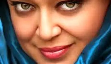 خانم بازیگر مشهور ایران پس از کاهش وزن ۴۰ کیلوگرمی 