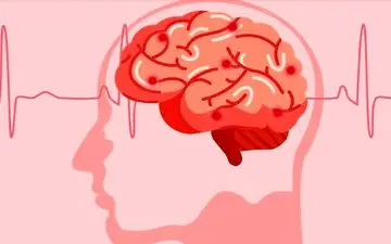 سکته کوچک؛ هشدار جدی برای ۹۰ روز سرنوشت‌ساز