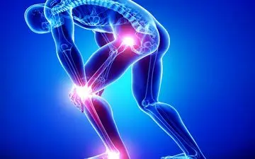  خطر ابتلا به آرتروز در این افراد بیشتر است!