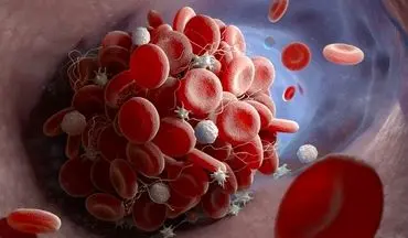 لخته شدن خون | این نوشیدنی خطر لخته شدن خون را افزایش می‌دهد