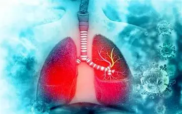  پیشگیری از ابتلا به "آنفلوآنزا" با تدابیر طب سنتی/ تقویت ریه‌ها با بادکش‌‌ 