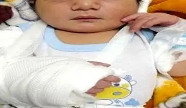 ماجرای تولد نوزاد خرمشهری با دست شکسته