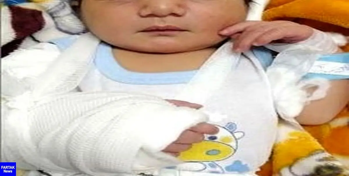 ماجرای تولد نوزاد خرمشهری با دست شکسته