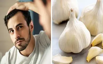 خواص سیر برای موی سر چیست؟