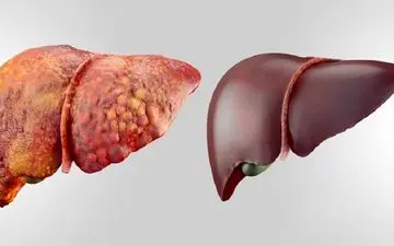 میوه ای که کبدتان را از نو می سازد