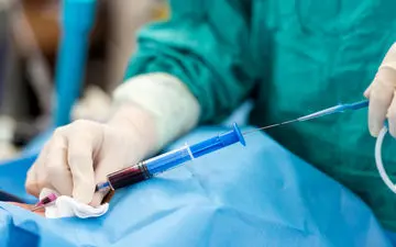  آنژیوگرافی و دانستنی‌هایی درباره آن