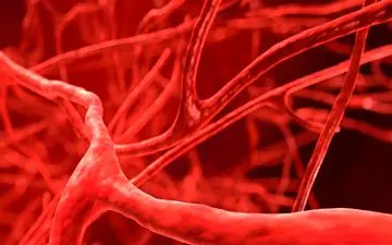 4 علامت عجیب و خاموش انسداد عروق را بشناسید