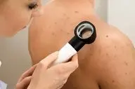 جوش روی کمر چه زمانی خطرناک است؟ + روش درمان