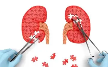 افراد افسرده در معرض نارسایی کلیه