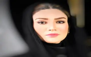 بازیگران زن ایرانی رکوددار عمل های زیبایی/ از الناز حبیبی تا نیوشا ضیغمی
