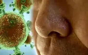 درمورد احتقان بیشتر بدانید