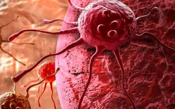 برای پیشگیری از سرطان این کارها را انجام ندهید/طب سنتی