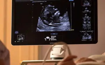 دستور رئیس جمهور برای نجات فرزندان «سقط» چه بود؟

