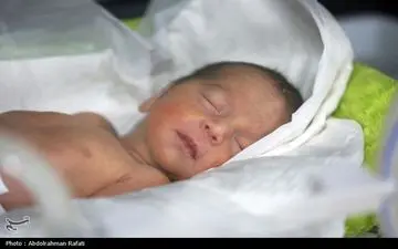 مصرف شیر مادر باعث افزایش زردی نوزاد می‌شود؟