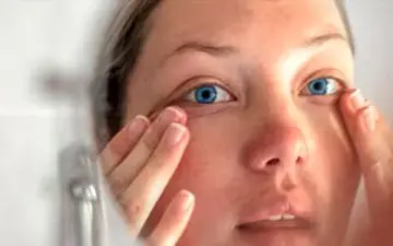 درباره بیماری تیروئید چشمی بیشتر بدانید
