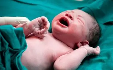 زردی نوزادان چه دلیلی دارد؟