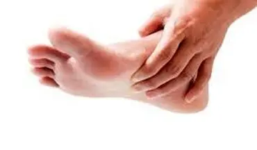 با این اشتباهات باعث تاول و ترک خوردگی پای خود می‌شوید