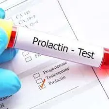 علت تجویز آزمایش خون پرولاکتین چیست؟