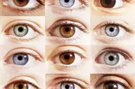 عمل تغییر رنگ چشم برای افراد سالم پرخطر است

