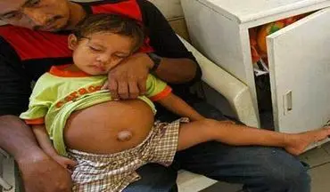 حاملگی باور نکردنی دختر بچه 3 ساله