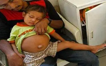 حاملگی باور نکردنی دختر بچه 3 ساله