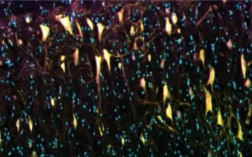 راهی جدید برای درمان درد مزمن 