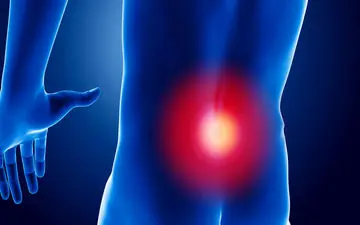 درمان سه سوته سیاتیک با پیاز!