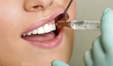 جرم‌گیری برای دندان مضر است؟یا نه؟