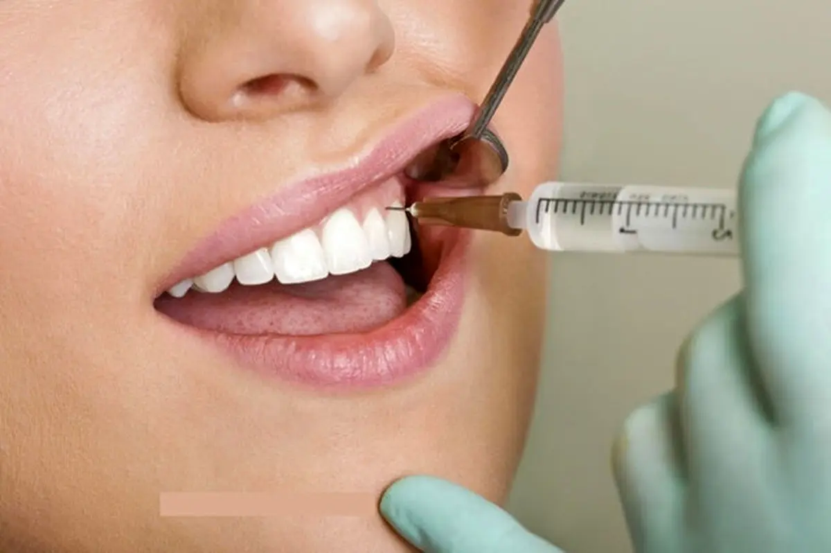 جرم‌گیری برای دندان مضر است؟یا نه؟