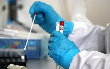 اعلام آخرین فهرست آزمایشگاه های تشخیص کووید ۱۹ 
