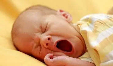 دانستنی هایی درباره خمیازه