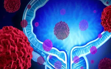 سرطان پروستات چیست؟