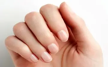 وقتی شکل و شمایل ناخن ها خبر از بیماری می دهد