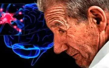 اختلال در ریتم شبانه روزی بدن نشانه ابتلا به پارکینسون است
