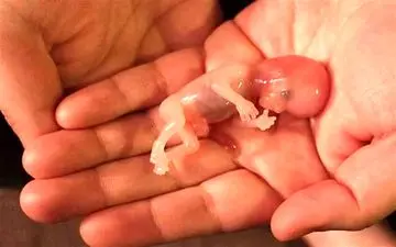 خبر گم‌شدن جنین‌ها در بیمارستان آبان تکذیب شد