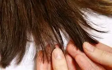 از مشکلی به نام موخوره بیشتر بدانیم