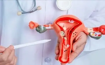 ارتباط اندومتریوز با بیماری قلبی