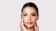 
چین و چروک هایی که خبراز بیماری می دهند