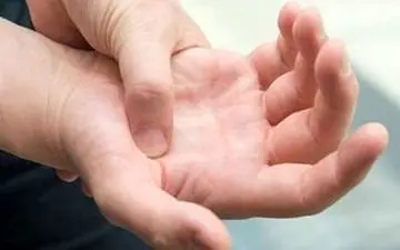 
خارش کف دست به چه علت است؟