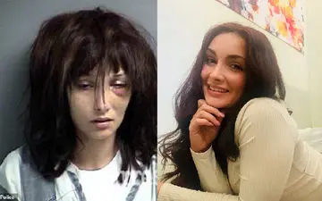 زن معتادی که پس از ۱۹ بار اوردوز بالاخره ترک کرد