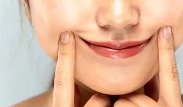 رفع خط خنده در خانه: کرم و مواد طبیعی مؤثر