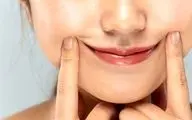 رفع خط خنده در خانه: کرم و مواد طبیعی مؤثر