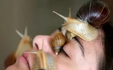 حلزن،جایگزینی برای بوتاکس؟