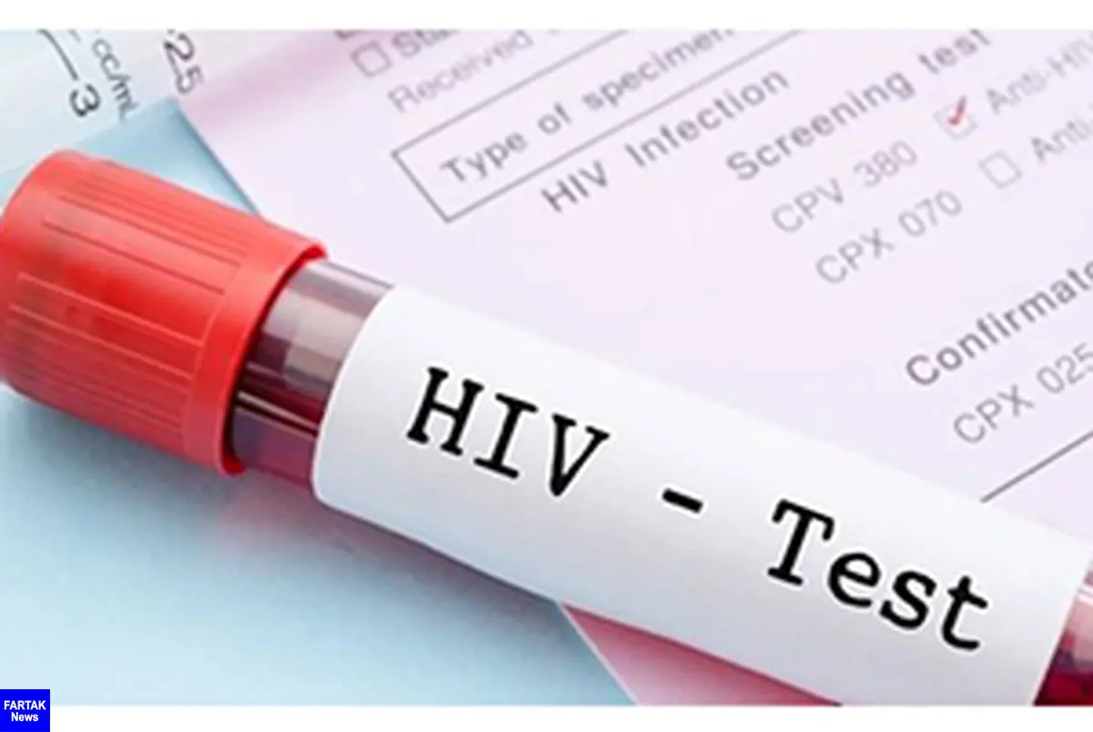 آزمایش ایدز چگونه است و چه زمانی پاسخ آن مشخص می شود؟
